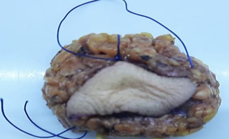 Description of image