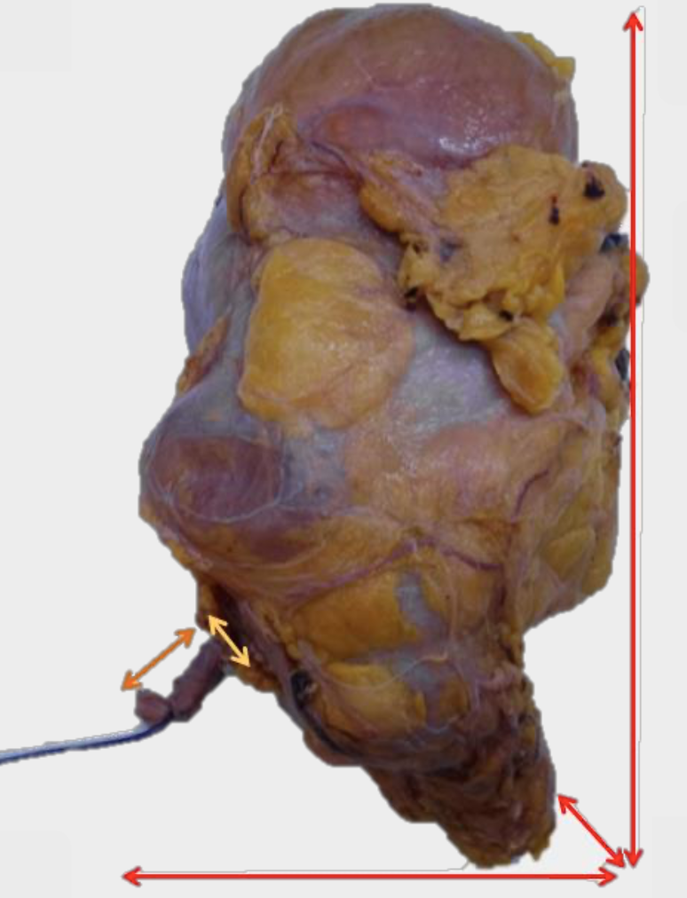 Description of image