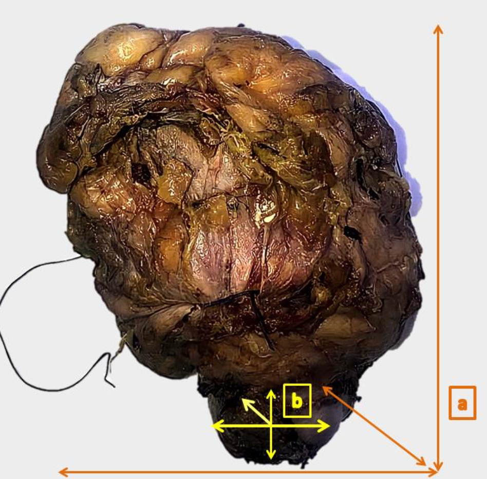 Description of image